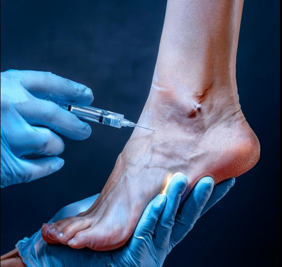 Mesoterapia